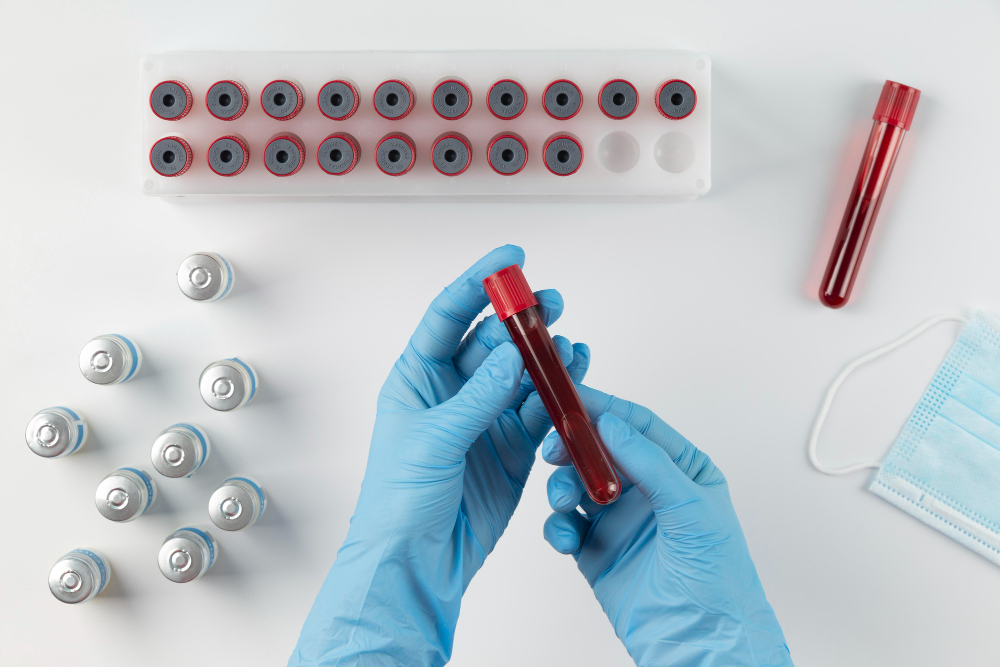 early signs of alzheimer’s, alzheimer’s blood test, phospho-tau test, amyloid beta 42 40 ratio, neurofilament light chain, gfap brain inflammation, functional medicine alzheimer’s prevention, how to detect alzheimer’s early, biomarkers for cognitive decline, brain health optimization, alzheimer’s prevention functional medicine